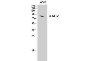 Western Blotting (WB) image for anti-Dihydropyrimidinase-Like 2 (DPYSL2) (Ser306), (Ser309) antibody (ABIN3179981) (DPYSL2 antibody  (Ser306, Ser309))