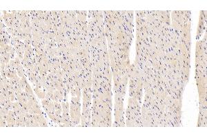 Immunohistochemistry (IHC) image for anti-Mitogen-Activated Protein Kinase 9 (MAPK9) (AA 130-387) antibody (ABIN7439366)
