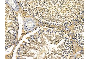 ABIN6257331 and ABIN6275242 at 1/100 staining rat testis tissue by IHC-P. (MRPL3 antibody  (N-Term))