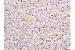 Immunohistochemistry (IHC) image for anti-Angiotensinogen (serpin Peptidase Inhibitor, Clade A, Member 8) (AGT) (AA 51-110) antibody (ABIN724115)