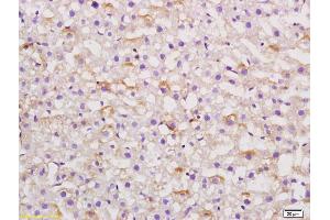 Formalin-fixed and paraffin embedded rat liver labeled with Anti AGT Polyclonal Antibody,Unconjugated (ABIN724115) at 1:200 followed by conjugation to the secondary antibody and DAB staining. (AGT antibody  (AA 51-110))