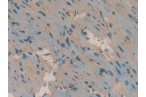 Immunohistochemistry (IHC) image for anti-Apolipoprotein H (Beta-2-Glycoprotein I) (APOH) (AA 21-345) antibody (ABIN7431614)