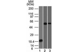 Western blot analysis of 1) partial recombinant protein, 2) A549 and 3) A431 stained with TOX-3 antibody (TOX3/1124).