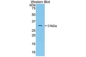 Western blot analysis of the recombinant protein. (TAB1 antibody  (AA 189-439))