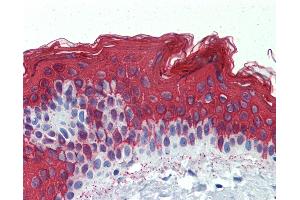 Anti-KRT1 / Cytokeratin 1 antibody IHC of human skin. (Cytokeratin 1 antibody  (C-Term))