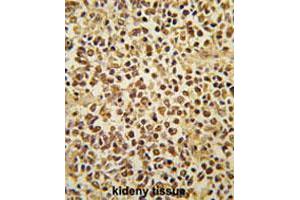 Formalin-fixed and paraffin-embedded human kidney tissue reacted with SNAI1 polyclonal antibody  , which was peroxidase-conjugated to the secondary antibody, followed by AEC staining. (SNAIL antibody  (AA 9-39))