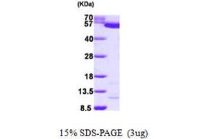 SDS-PAGE (SDS) image for Pyruvate Kinase, Liver and RBC (PKLR) (AA 47-574) (Active) protein (His tag) (ABIN667822)