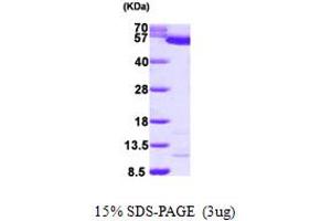 SDS-PAGE (SDS) image for Pyruvate Kinase, Liver and RBC (PKLR) (AA 47-574) protein (His tag) (ABIN667822)