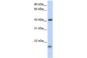 WB Suggested Antibody Titration: 0. (SHOX2 antibody  (Middle Region))