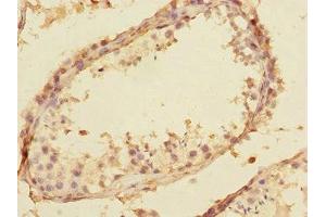 Immunohistochemistry of paraffin-embedded human testis tissue using ABIN7170630 at dilution of 1:100 (Splicing factor U2AF 26 kDa subunit (U2AF1L4) (AA 1-202) antibody)