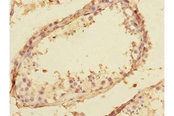 Splicing factor U2AF 26 kDa subunit (U2AF1L4) (AA 1-202) antibody