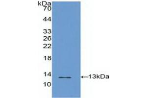 Detection of Recombinant S100A4, Human using Polyclonal Antibody to S100 Calcium Binding Protein A4 (S100A4) (s100a4 antibody  (AA 2-101))