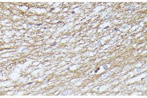 Immunohistochemistry of paraffin-embedded Rat brain using SEPT5 Polyclonal Antibody at dilution of 1:100 (40x lens). (Septin 5 antibody)