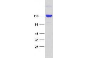 Validation with Western Blot (BICD1 Protein (Transcript Variant 1) (Myc-DYKDDDDK Tag))