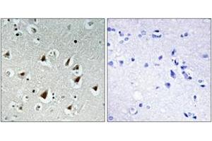Immunohistochemistry analysis of paraffin-embedded human brain tissue, using ZHX2 Antibody. (ZHX2 antibody  (AA 751-800))