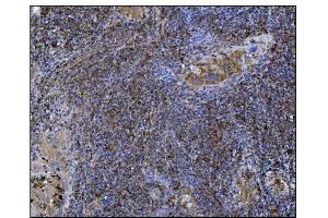 IHC analysis of POGLUT1 using anti-POGLUT1 antibody (ABIN7602910).