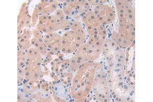 Used in DAB staining on fromalin fixed paraffin- embedded Kidney tissue (ACD antibody  (AA 21-175))