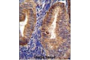 RUTBC1 Antibody (C-term) (ABIN655520 and ABIN2845034) immunohistochemistry analysis in formalin fixed and paraffin embedded human uterus tissue followed by peroxidase conjugation of the secondary antibody and DAB staining. (SGSM2 antibody  (C-Term))