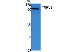 Western Blotting (WB) image for anti-Transient Receptor Potential Cation Channel, Subfamily V, Member 3 (TRPV3) (Internal Region) antibody (ABIN3187651) (TRPV3 antibody  (Internal Region))
