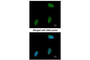 ICC/IF Image Immunofluorescence analysis of paraformaldehyde-fixed human pancreatic cancer cell line, using ERG, antibody at 1:50 dilution. (ERG antibody  (C-Term))