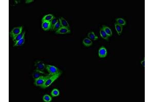 Immunofluorescent analysis of HepG2 cells using ABIN7167466 at dilution of 1:100 and Alexa Fluor 488-congugated AffiniPure Goat Anti-Rabbit IgG(H+L) (ERBB4 antibody  (AA 1027-1204))