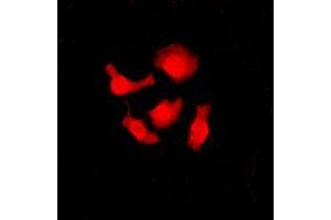 Immunofluorescent analysis of SRSF3 staining in HeLa cells.