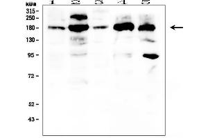 Western blot analysis of PDGFRA using anti- PDGFRA antibody . (PDGFRA antibody  (C-Term))