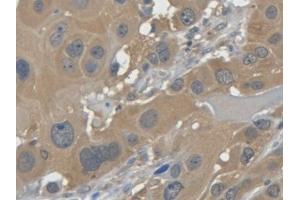 DAB staining on IHC-P; Samples: Human Esophagus (LGALS7 antibody  (AA 1-136))
