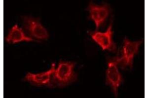 ABIN6275343 staining LOVO by IF/ICC. (DECR2 antibody  (Internal Region))