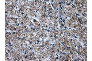 Immunohistochemical staining of paraffin-embedded liver tissue using anti-ATP5B mouse monoclonal antibody. (ATP5B antibody)