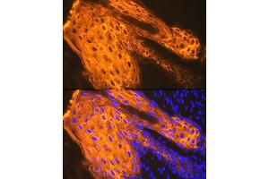 Immunofluorescence (IF) image for anti-Keratin 1 (KRT1) antibody (ABIN7268085)