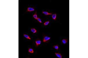 Image no. 2 for anti-CD9 (CD9) (Middle Region) antibody (ABIN5552041)