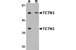 Western Blotting (WB) image for anti-Tectonic Family Member 3 (TCTN3) (C-Term) antibody (ABIN1030726) (TCTN3 antibody  (C-Term))