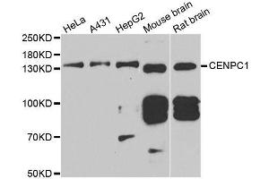 Western blot analysis of extracts of various cell lines, using CENPC antibody. (Centromere Protein C Pseudogene 1 (CENPCP1) (AA 1-300) antibody)