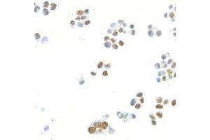 Immunocytochemistry (ICC) image for anti-Mediator Complex Subunit 1 (MED1) (AA 1550-1581) antibody (ABIN7455140) (Recombinant MED1 antibody  (AA 1550-1581))