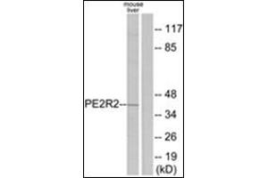 Western blot analysis of extracts from mouse liver cells, using PE2R2 Antibody.