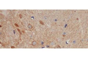 Immunohistochemistry of paraffin-embedded Mouse brain using BCL-x Polyclonal Antibody at dilution of 1:50