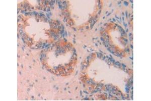 Immunohistochemistry (IHC) image for anti-Apolipoprotein A-V (APOA5) (AA 167-335) antibody (ABIN7427942)