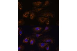 Immunofluorescence analysis of U-2 OS cells using PRSS8 antibody (ABIN7269583) at dilution of 1:100. (PRSS8 antibody  (C-Term))