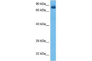 Host:  Rabbit  Target Name:  RIPK4  Sample Tissue:  Human HT1080 Whole Cell  Antibody Dilution:  1ug/ml