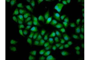 Immunofluorescence staining of Hela cells with ABIN7165140 at 1:166, counter-stained with DAPI. (BICD2 antibody  (AA 511-625))
