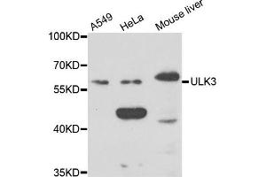 Western blot analysis of extracts of various cell lines, using ULK3 antibody. (ULK3 antibody)