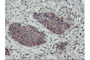 Image no. 5 for anti-Zinc Finger Protein 365 (ZNF365) (AA 108-407) antibody (ABIN1490829) (ZNF365 antibody  (AA 108-407))