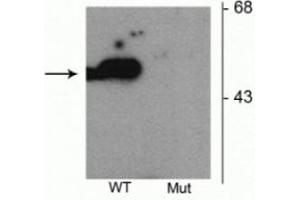 Western blot of HEK293 cells transfected with Parkin wild type (WT) and Parkin S101 mutant (Mut) showing the specific immunolabeling of the ~52 kDa parkin protein phosphorylated at Ser101. (Parkin antibody  (pSer101))