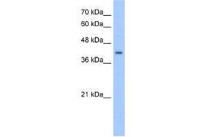 WB Suggested Anti-PHACS Antibody Titration:  2. (PHACS antibody  (Middle Region))