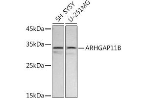 Western blot analysis of extracts of various cell lines, using B antibody (ABIN7269963) at 1:500 dilution. (ARHGAP11B antibody  (AA 218-267))