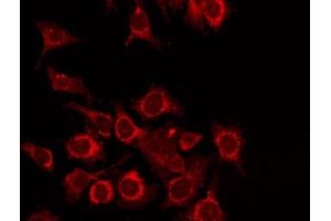 ABIN6268762 staining Hela by IF/ICC. (TDG antibody  (Internal Region))