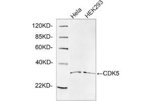Western blot analysis of cell lysates using 1 µg/mL Rabbit Anti-CDK5 Polyclonal Antibody (ABIN398921) The signal was developed with IRDyeTM 800 Conjugated Goat Anti-Rabbit IgG. (CDK5 antibody  (C-Term))