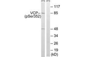 Western blot analysis of extracts from NIH-3T3 cells treated with starved 24h, using VCP (Phospho-Ser352) Antibody.