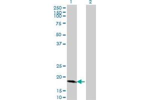 Western Blot analysis of CDKN2D expression in transfected 293T cell line by CDKN2D monoclonal antibody (M08), clone 2E10. (CDKN2D antibody  (AA 1-166))